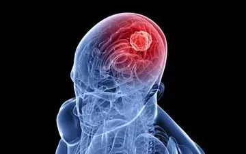 مصرف بیش از حد" اسیدفولیک" منجر به زوال عقل می‌شود!
