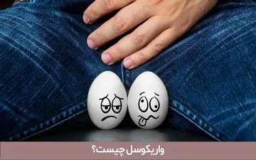 واریکوسل، مشکلی که بر باروری مردان تأثیر می‌گذارد | هرآنچه باید از واریکوسل بدانید