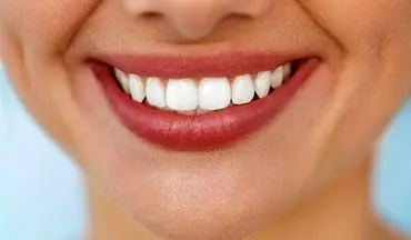 برای ترمیم و زیبایی دندان چه روش هایی وجود دارد| با این روش ها لبخند زیباتری داشته باشید