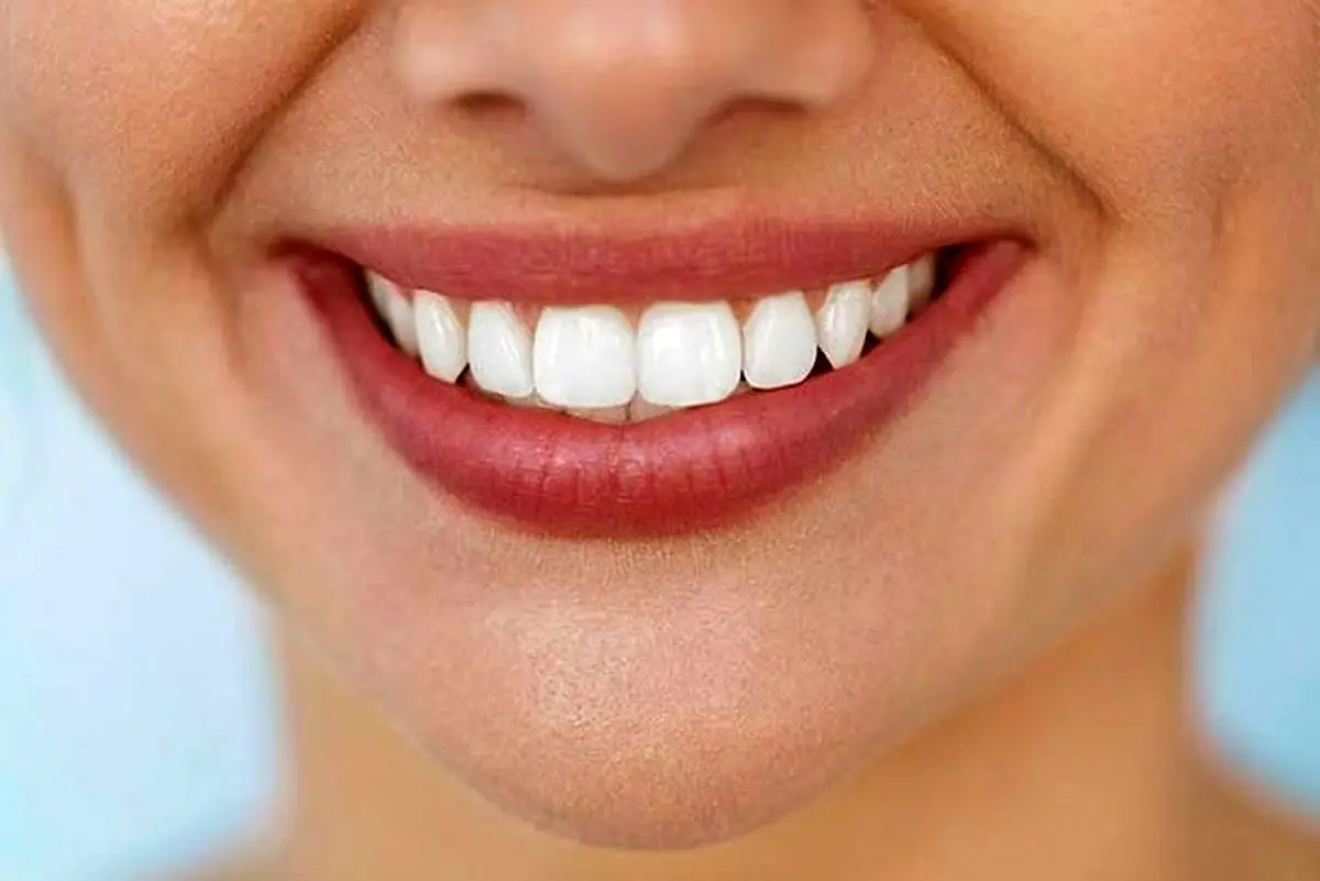 برای ترمیم و زیبایی دندان چه روش هایی وجود دارد| با این روش ها لبخند زیباتری داشته باشید