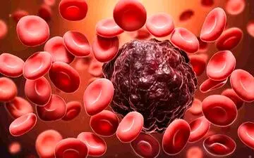 عامل خطرناک ابتلا به سرطان خون

