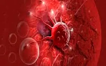 سرطان پستان| زنان به این علائم حساس باشند!