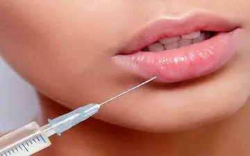 فیلر لب؛ چه چیزهایی را قبل از تزریق فیلر باید بدانید؟
