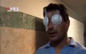 تصاویر تلخ از آسیب دیدگان ناآرامی‌های بنزینی اخیر کشور در بیمارستان