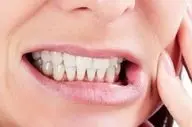 نکته طلایی برای پیشگیری از پوسیدگی دندان