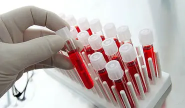  آزمایش خون| 20 سوال مهم درباره آزمایش خون که باید بدانید