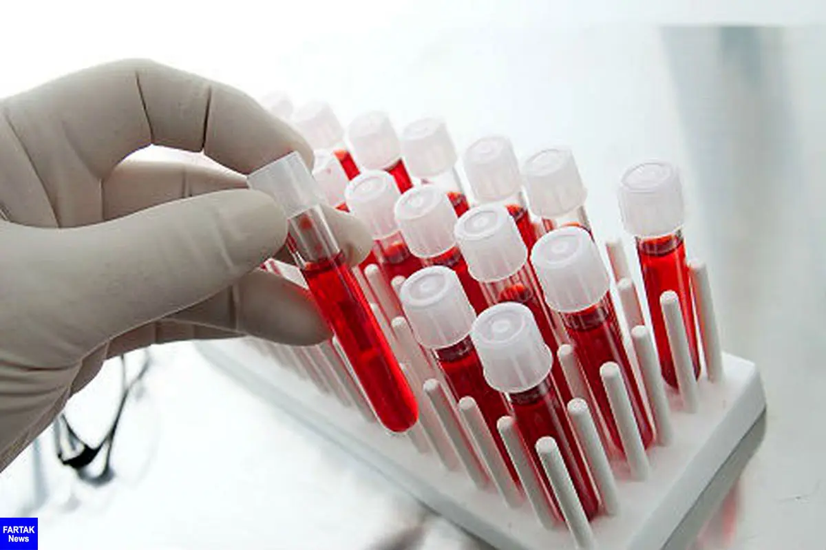  آزمایش خون| 20 سوال مهم درباره آزمایش خون که باید بدانید