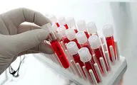 20 سوال مهم درباره آزمایش خون