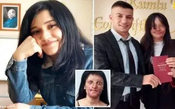 اقدام عجیب فرد اسیدپاش/ او بعد از آزادی به خواستگاری دختر جوان رفت+عکس‌ها 