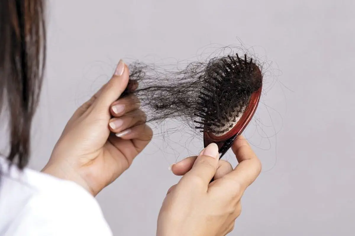 شایع‌ترین علل ریزش مو چه چیزهایی هستند؟