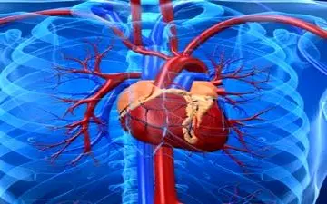 توصیه های کلیدی برای پیشگیری از سکته قلبی