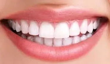 راهکارهایی برای داشتن دندان هایی سفید و زیبا