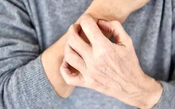 نشانه‌های پوستی که نباید نادیده بگیرید