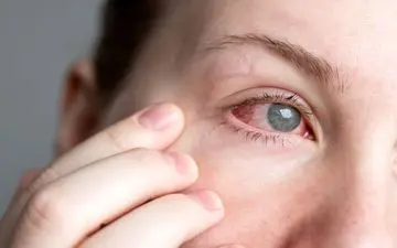 چشم‌هایتان خشک است؟ با این ترفندهای ساده، چشمانتان را بدون قطره مرطوب نگه دارید!