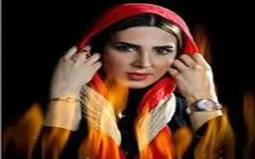 خانم بازیگر پرحاشیه درحال لمینت دندان