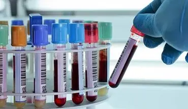 شناسایی بهترین روش درمان سرطان با چند قطره خون