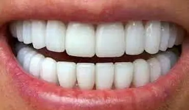کدام داروها برای دندان مضر هستند؟