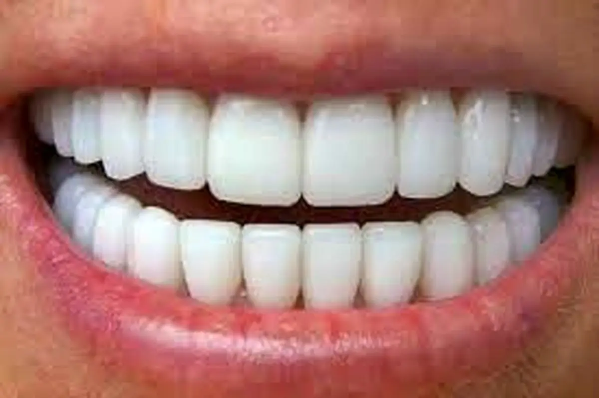 کدام داروها برای دندان مضر هستند؟
