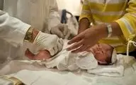 ختنه و اوتیسم: آیا واقعاً این دو با هم ارتباط دارند؟