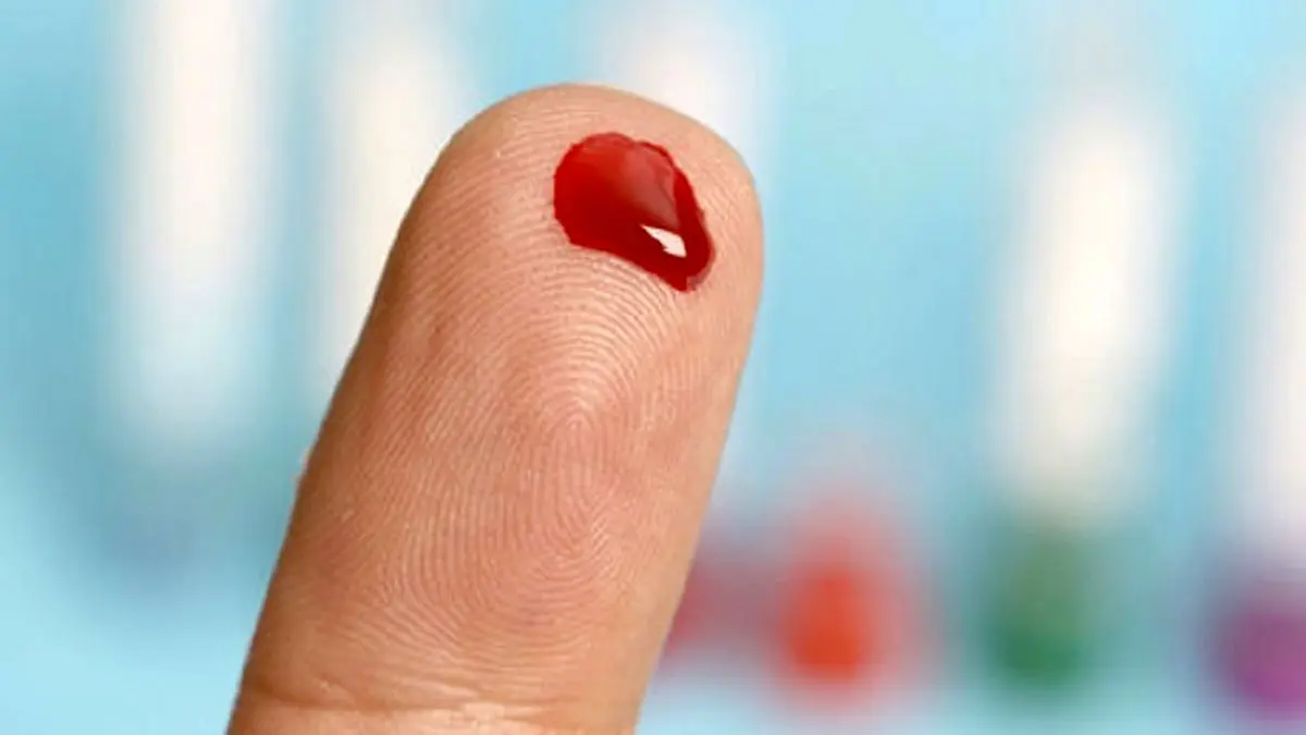 ۹۰ درصد ایرانیها دارای این گروه خونی هستند