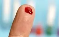 ۹۰ درصد ایرانی‌ها دارای این گروه خونی هستند