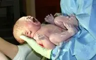 کدام نوع زایمان برای سلامت مادر و جنین بهتر است؟