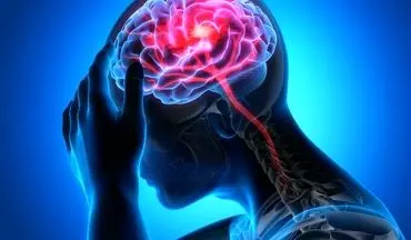 سکته مغزی دومین عامل مرگ در کشور/روزانه 200 تهرانی دچار سکته مغزی می‌شوند