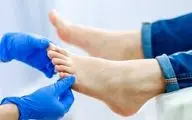 تشخیص زودهنگام، کلید درمان مؤثر انحراف شست پا