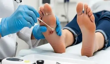 کاهش خطر قطع عضو بیماران دیابتی با الگوریتم‌های هوش مصنوعی