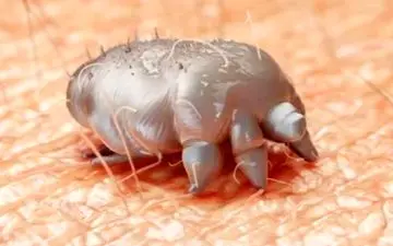 در مورد بیماری گال چه می دانید؟