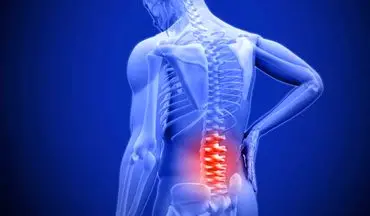 عامل پنهان کمردردهای مزمن مشخص شد