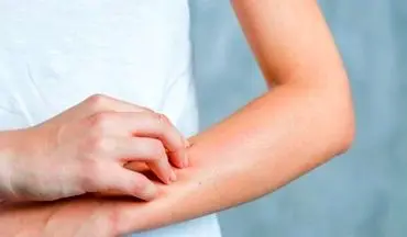 ۷ روش ساده برای جلوگیری از شل شدن پوست