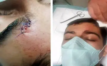 مدافع پیکان راهی بیمارستان شد