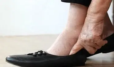ورم یا کبودی دست و پا، علامت هشداردهنده این بیماری خطرناک است؛ جدی بگیرید