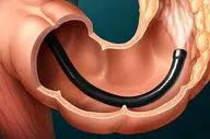 با خوردن این خوراکی از سرطان روده بزرگ  پیشگیری کنید!