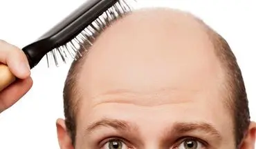 راهکارهایی برای جلوگیری از ریزش موی سر