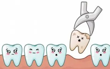 چرا بعد از کشیدن دندان دهان مان بو میگیرد؟ /چگونه این بوی بد را از بین ببریم؟