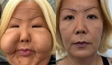 داستان ترسناک اینفلوئنسر برزیلی: جراح تقلبی ای که زندگی‌اش را تغییر داد!