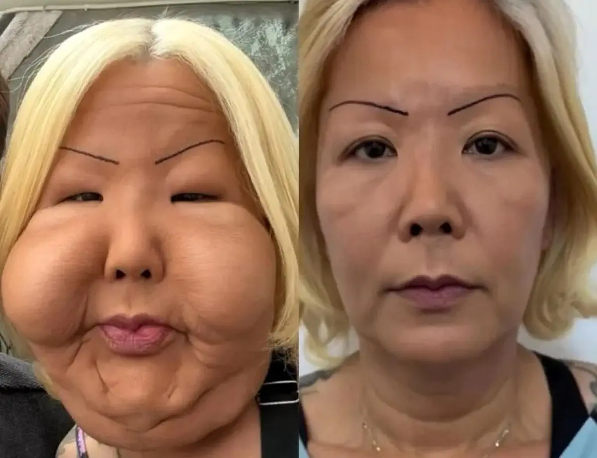 داستان ترسناک اینفلوئنسر برزیلی: جراح تقلبی ای که زندگی‌اش را تغییر داد!