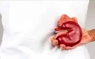 بایدها و نبایدهای تغذیه ای برای بیماران کلیوی