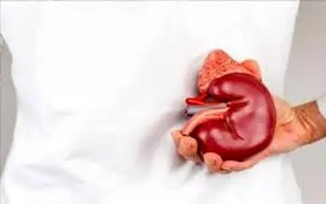 بایدها و نبایدهای تغذیه ای برای بیماران کلیوی