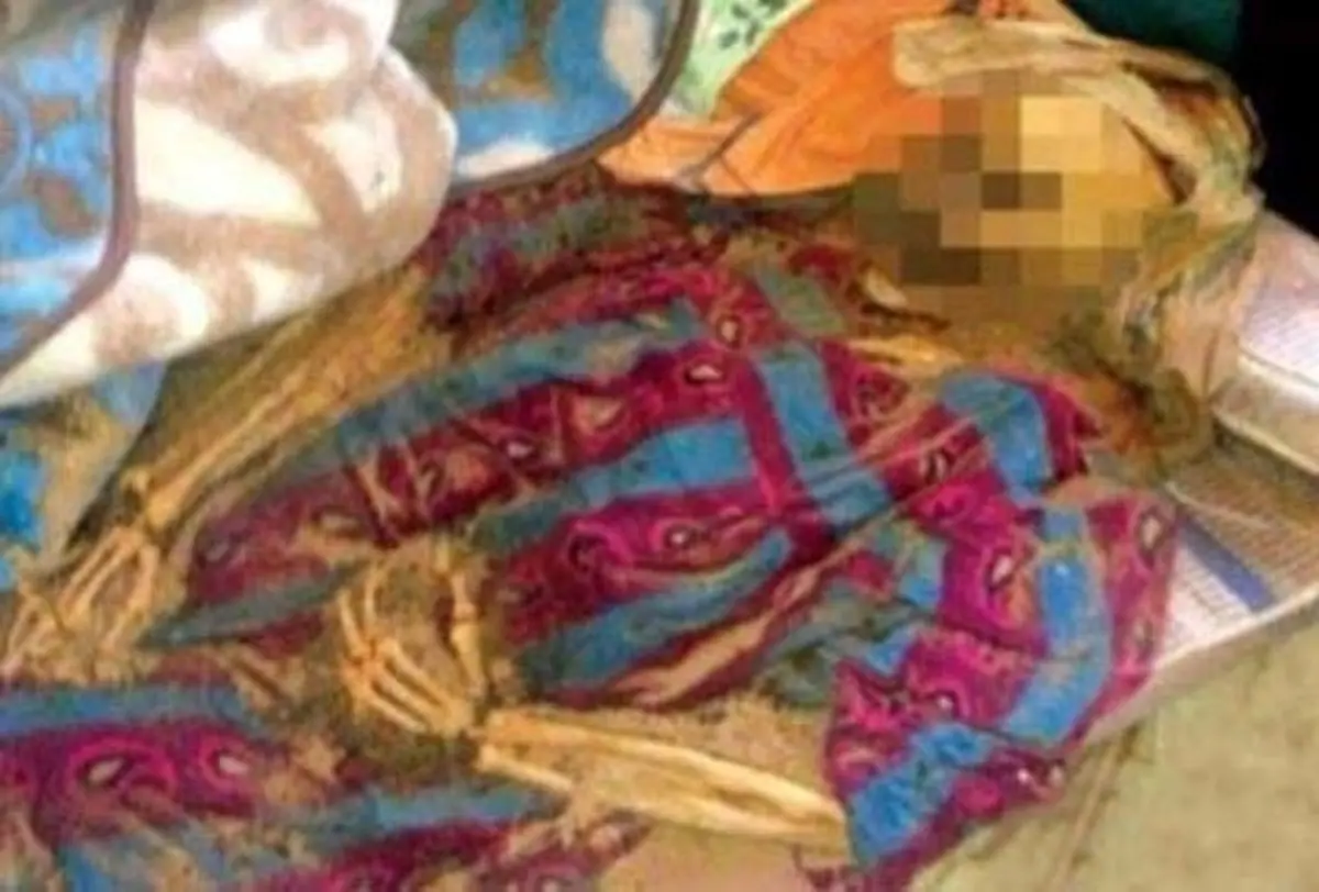 پودر شدن جسد زنی در بسترش پس از ۸ ماه! + عکس