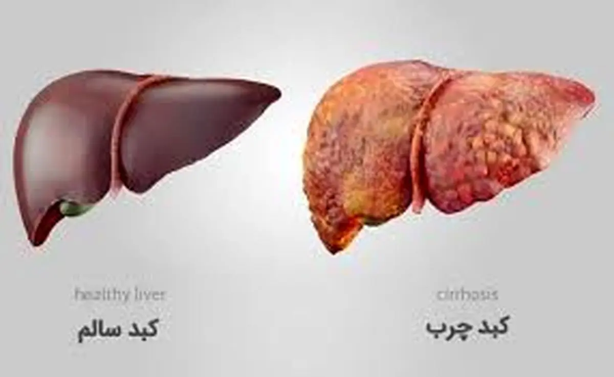   کم آبی دشمن کبد شماست​ 