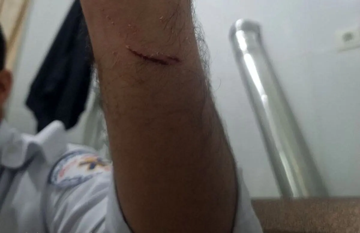 حمله به امدادگر اورژانس ۱۱۵ در کردستان توسط فرد بیمارنما