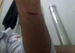 حمله به امدادگر اورژانس ۱۱۵ در کردستان توسط فرد بیمارنما