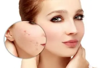 ۶ هشدار که پوست در مورد وضعیت رژیم غذایی می دهد!