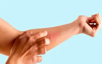 چرا خاراندن لذت‌ دارد؟