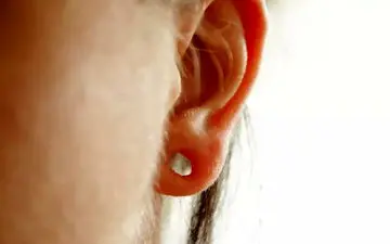 عوامل بزرگ شدن یا پارگی سوراخ لاله گوش