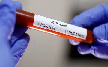 عدم صدور بلیت برای افراد مبتلا به کرونا