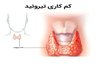 تاثیر رژیم غذایی در سلامت تیروئید 